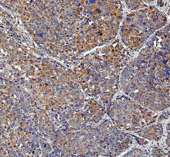 TRNT1 Rabbit Polyclonal Antibody