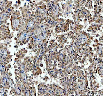 TRNT1 Rabbit Polyclonal Antibody