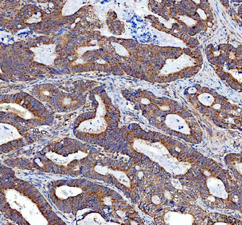 TRNT1 Rabbit Polyclonal Antibody