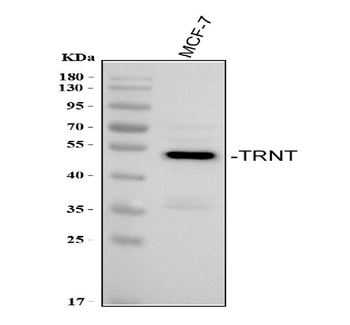 TRNT1 Rabbit Polyclonal Antibody