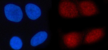 N4BP1 Rabbit Polyclonal Antibody