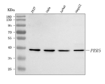 PRR5 Rabbit Polyclonal Antibody