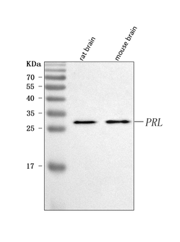 Prolactin/PRL Rabbit Polyclonal Antibody