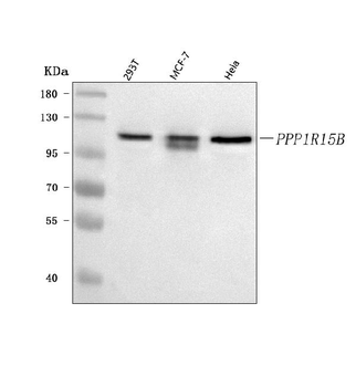 PPP1R15B Rabbit Polyclonal Antibody