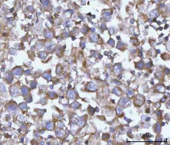 NANP Rabbit Polyclonal Antibody