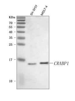 CRABP1 Rabbit Polyclonal Antibody