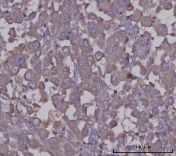 Angiotensinogen/AGT Rabbit Polyclonal Antibody