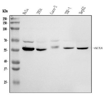 HEXA Rabbit Polyclonal Antibody