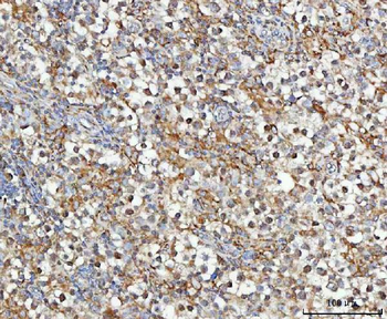 MOSPD2 Rabbit Polyclonal Antibody