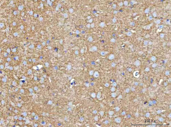 MOSPD2 Rabbit Polyclonal Antibody