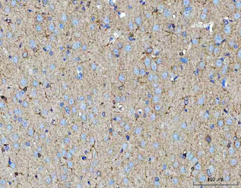 MOSPD2 Rabbit Polyclonal Antibody