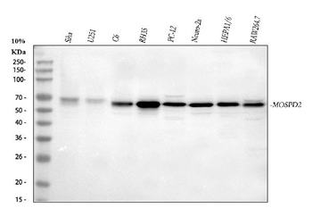 MOSPD2 Rabbit Polyclonal Antibody