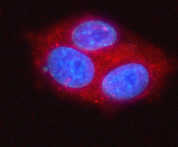 MOGAT2 Rabbit Polyclonal Antibody