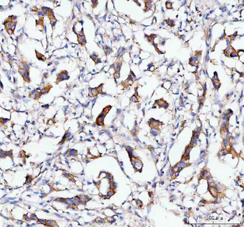 MOGAT2 Rabbit Polyclonal Antibody