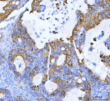 MOGAT2 Rabbit Polyclonal Antibody