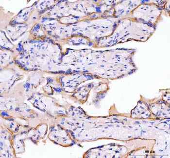 MOGAT2 Rabbit Polyclonal Antibody