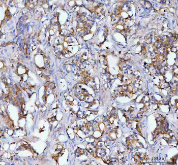 MOGAT2 Rabbit Polyclonal Antibody