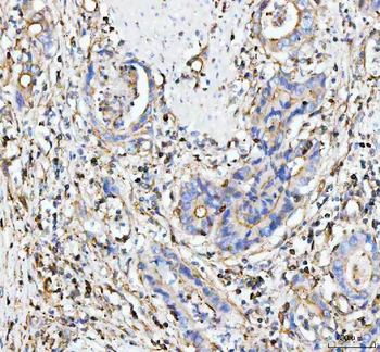 MOGAT2 Rabbit Polyclonal Antibody