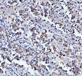 MOGAT2 Rabbit Polyclonal Antibody