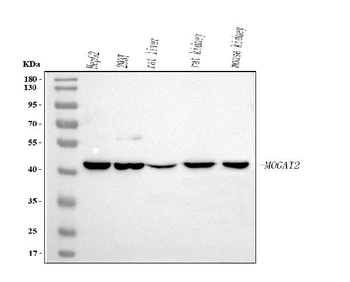 MOGAT2 Rabbit Polyclonal Antibody