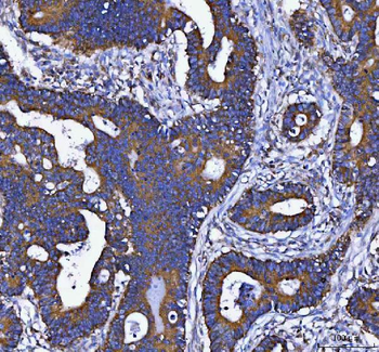 DAPK1 Rabbit Polyclonal Antibody