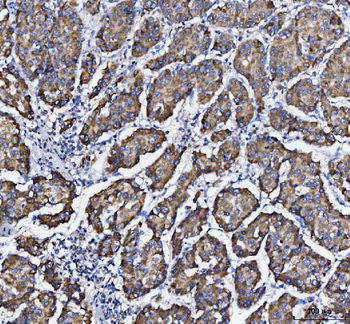 DAPK1 Rabbit Polyclonal Antibody