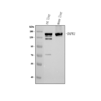 DAPK1 Rabbit Polyclonal Antibody
