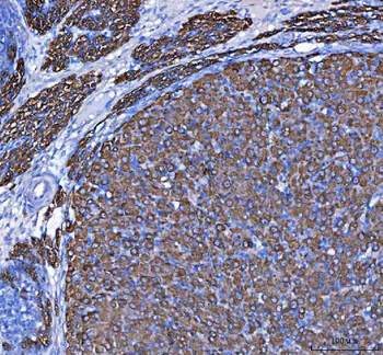 MELK Rabbit Polyclonal Antibody