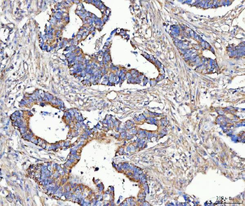 MCCC2 Rabbit Polyclonal Antibody