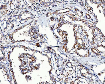 MCCC2 Rabbit Polyclonal Antibody