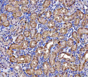 MCCC2 Rabbit Polyclonal Antibody