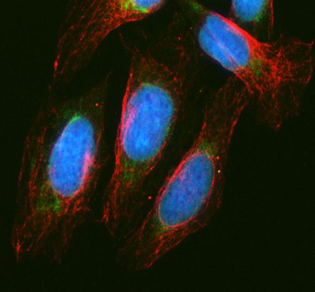 MCCC1 Rabbit Polyclonal Antibody