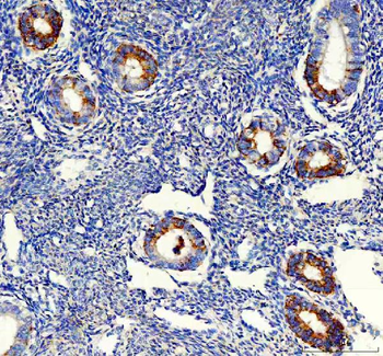 MCCC1 Rabbit Polyclonal Antibody