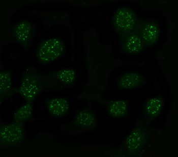 MYT1L Rabbit Polyclonal Antibody