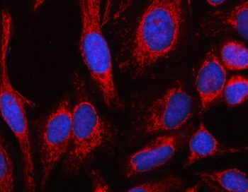 MSLNL Rabbit Polyclonal Antibody