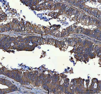 MSLNL Rabbit Polyclonal Antibody