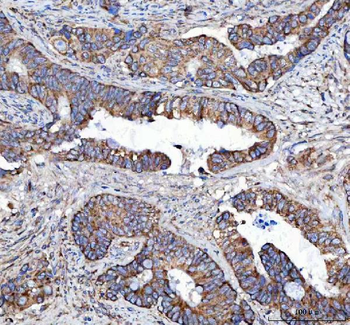 Malectin/MLEC Rabbit Polyclonal Antibody