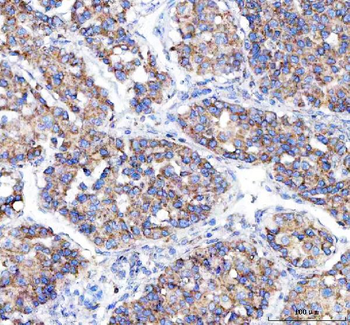 Malectin/MLEC Rabbit Polyclonal Antibody