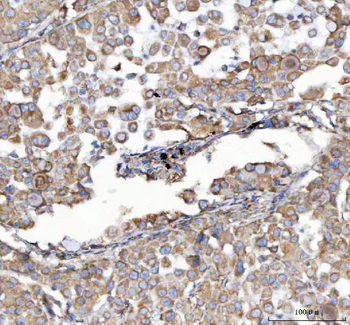 Malectin/MLEC Rabbit Polyclonal Antibody