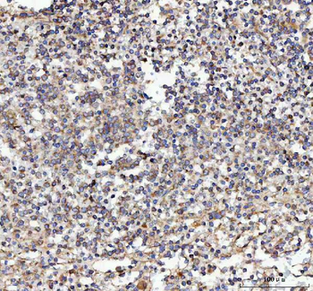 Malectin/MLEC Rabbit Polyclonal Antibody