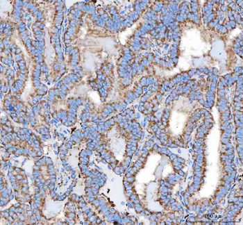 Malectin/MLEC Rabbit Polyclonal Antibody