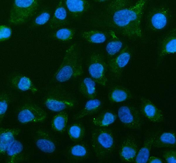 MAP6D1 Rabbit Polyclonal Antibody