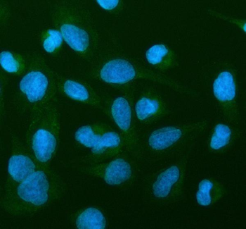 MAP6D1 Rabbit Polyclonal Antibody