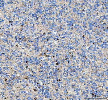 MAP6D1 Rabbit Polyclonal Antibody