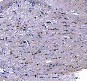 MAP6D1 Rabbit Polyclonal Antibody