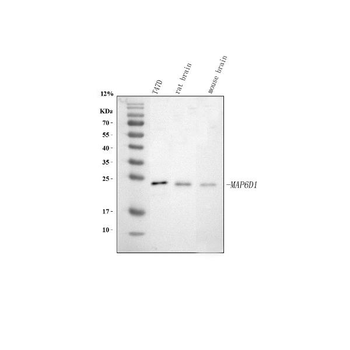 MAP6D1 Rabbit Polyclonal Antibody