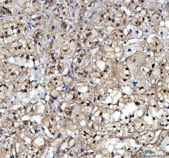 CBP20/NCBP2 Antibody