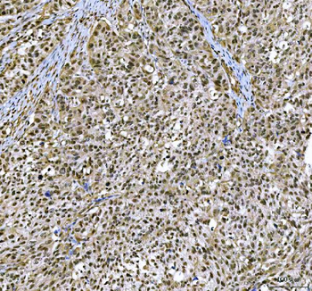 CBP20/NCBP2 Antibody