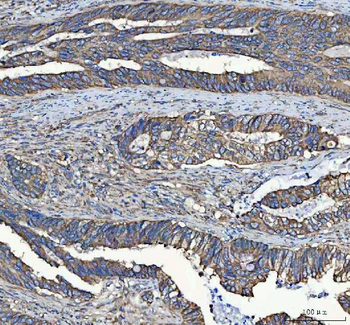 C19orf10/MYDGF Antibody