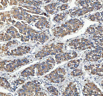 C19orf10/MYDGF Antibody